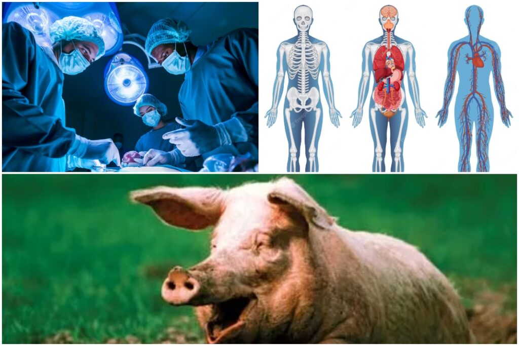 Medical breakthrough: Pig Kidney works in human body for one month