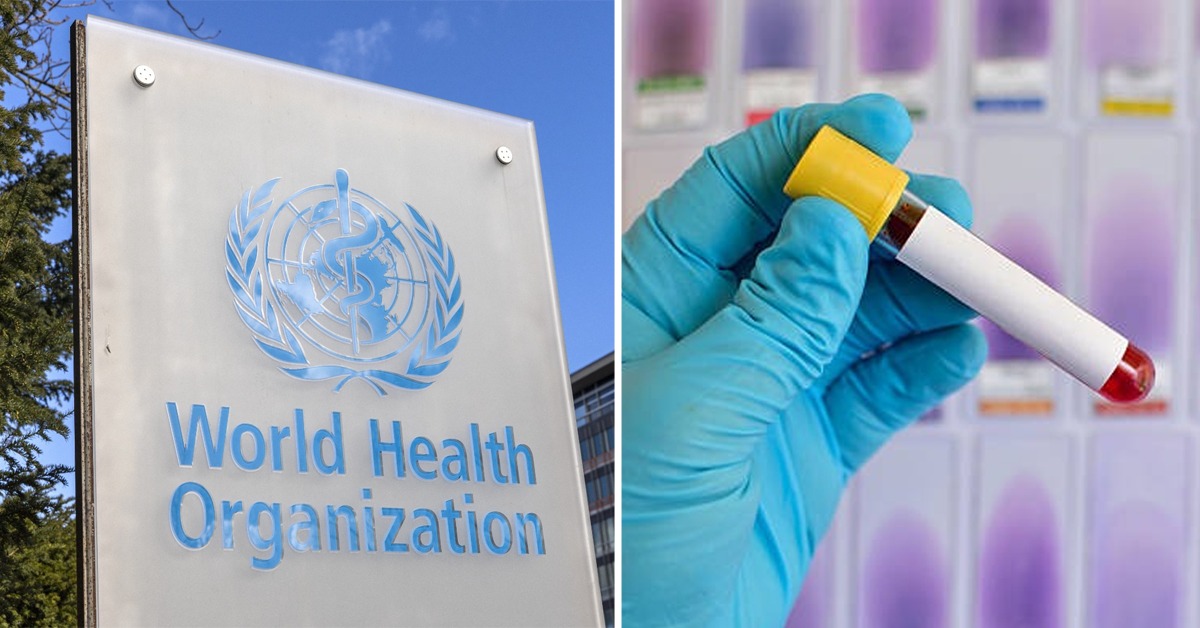 STIs, HIV and Hepatitis kill 2.5 million people every year – WHO report
