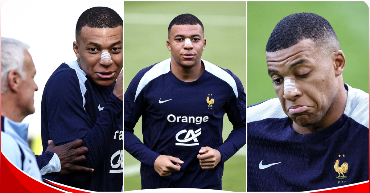 Will Mbappe play? Fans ask after the striker appears for training with a bandaged nose