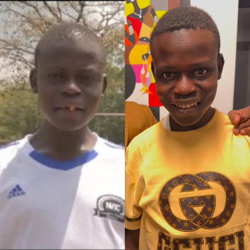 JKIA Boy Henry Omondi’s new smile after receiving a set of teeth