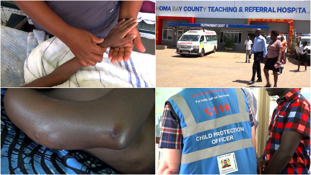 A broken waist, fractured arm: Grade 4 pupil hospitalised in Homa Bay after severe beating by classmate